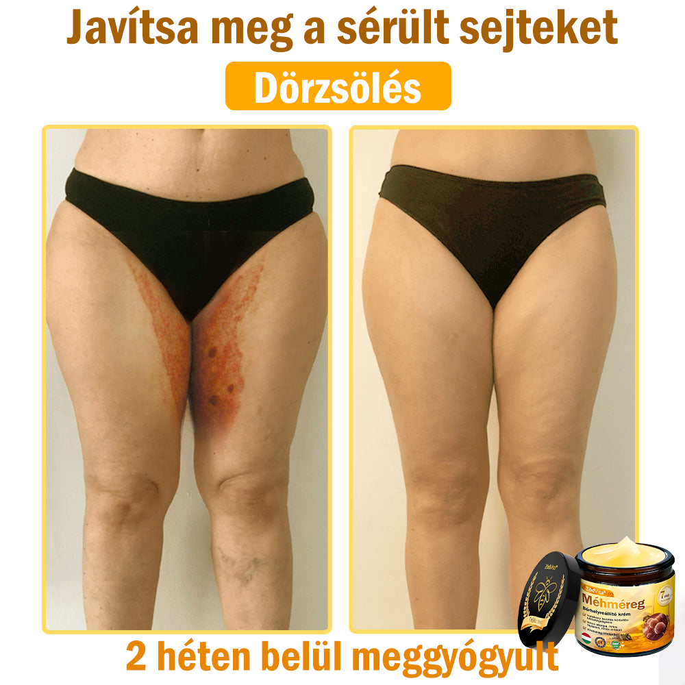 🌿Bőrgyógyász ajánlása💪ZödVita® Méhméreg Bőrhelyreállító Krém (👨⚕CE jóváhagyott)✅