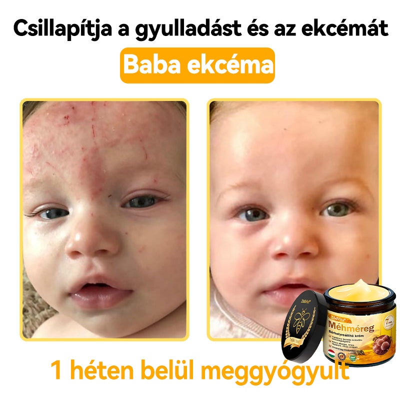 🌿Bőrgyógyász ajánlása💪ZödVita® Méhméreg Bőrhelyreállító Krém (👨⚕CE jóváhagyott)✅