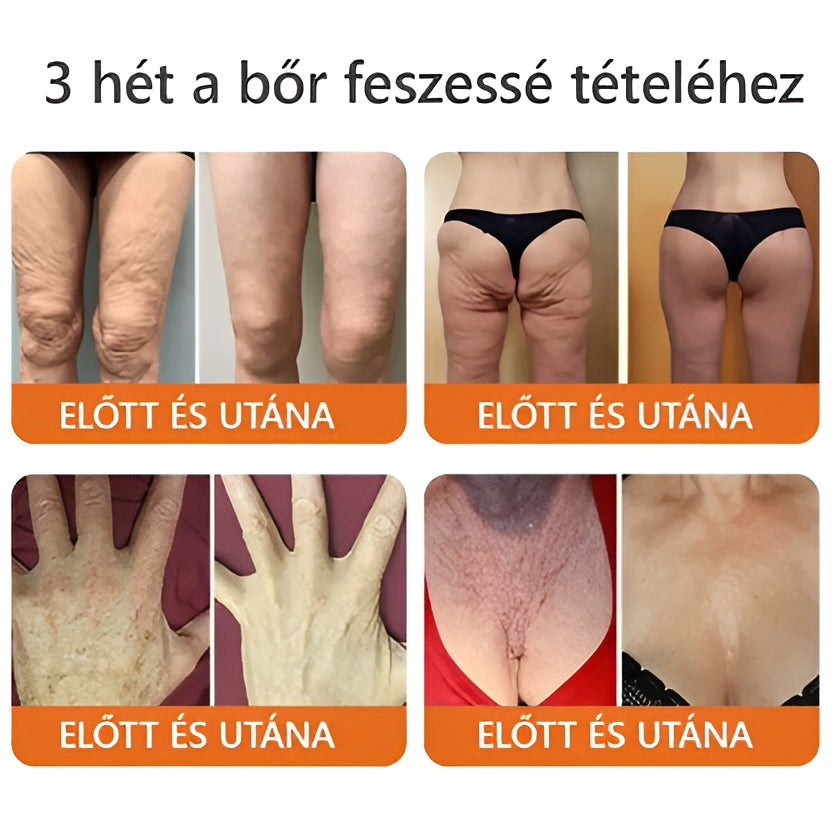✨✨Bőrgyógyász ajánlása ✨ ZödVita® Méhméreg Bőr Helyreállító Krém 🔥 Magyar fejlesztés, magyarországi gyártás és szállítás🔥✨