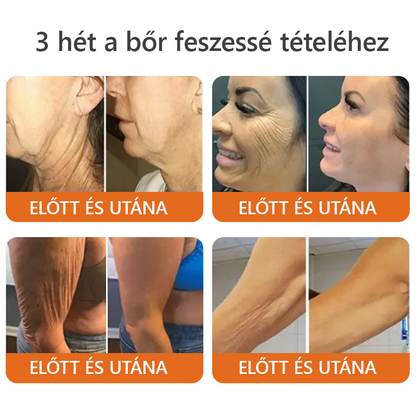 ✨✨Bőrgyógyász ajánlása ✨ ZödVita® Méhméreg Bőr Helyreállító Krém 🔥 Magyar fejlesztés, magyarországi gyártás és szállítás🔥✨
