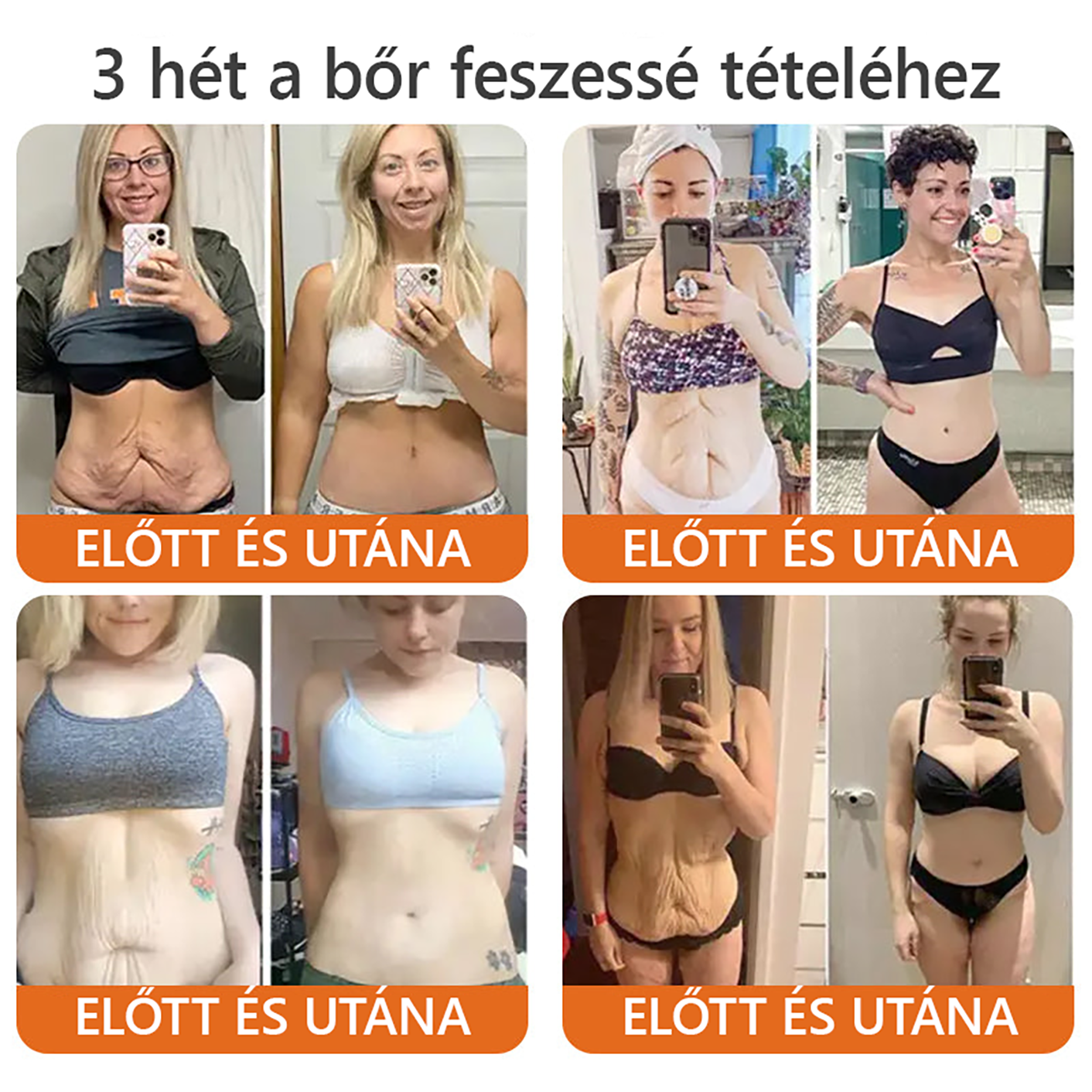 ✨✨Bőrgyógyász ajánlása ✨ ZödVita® Méhméreg Bőr Helyreállító Krém 🔥 Magyar fejlesztés, magyarországi gyártás és szállítás🔥✨
