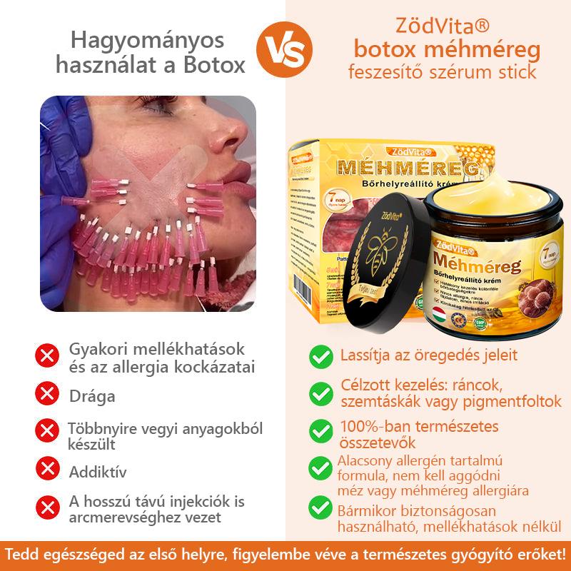 ✨✨Bőrgyógyász ajánlása ✨ ZödVita® Méhméreg Bőr Helyreállító Krém 🔥 Magyar fejlesztés, magyarországi gyártás és szállítás🔥✨