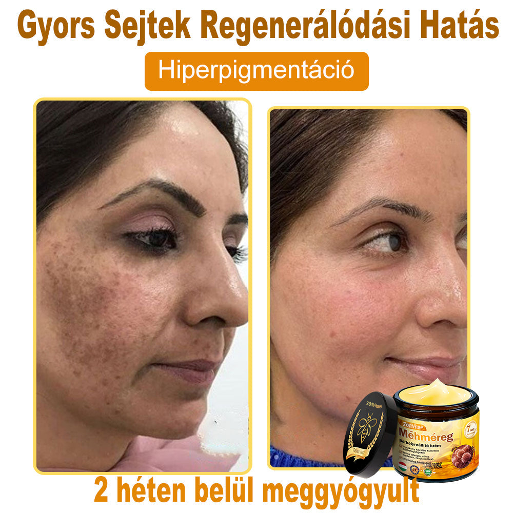 ✨✨Bőrgyógyász ajánlása ✨ ZödVita® Méhméreg Bőr Helyreállító Krém 🔥 Magyar fejlesztés, magyarországi gyártás és szállítás🔥✨