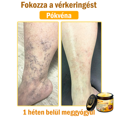 🌿Bőrgyógyász ajánlása💪ZödVita® Méhméreg Bőrhelyreállító Krém (👨‍⚕‍CE jóváhagyott)✅