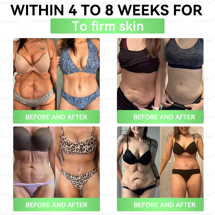 DOOEKA® GLP-1 20-az-1 Slim & Health Orális Oldat – Egyszerű napi használat, látványos eredmény 7 nap alatt, 100 milliárd aktív probiotikummal ✅ testsúlykezelés, szív-, cukorbetegség-, bél- és női egészség, feszes bőr, energia.