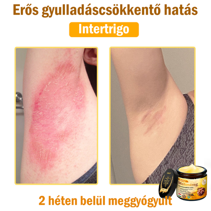 🌿Bőrgyógyász ajánlása💪ZödVita® Méhméreg Bőrhelyreállító Krém (👨‍⚕‍CE jóváhagyott)✅