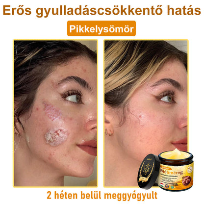 ✨✨Bőrgyógyász ajánlása ✨ ZödVita® Méhméreg Bőr Helyreállító Krém 🔥 Magyar fejlesztés, magyarországi gyártás és szállítás🔥🔥✨