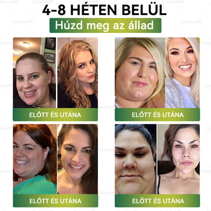 ✨│Hivatalos webáruház│ CrazyLeaf® SMGT-GLP-1 Nano Mikrotűs Tapasz 👉Természetes segítség túlsúly, fáradtság, bőr- és ízületi problémák ellen.ermészetes segítség túlsúly, fáradtság, bőr- és ízületi problémák ellen.🌿