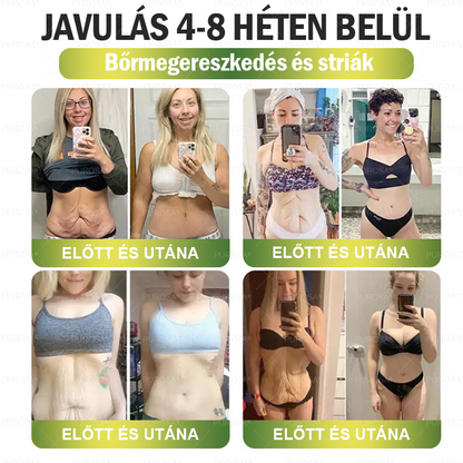 ✨│Hivatalos webáruház│ CrazyLeaf® SMGT-GLP-1 Nano Mikrotűs Tapasz 👉Természetes segítség túlsúly, fáradtság, bőr- és ízületi problémák ellen.ermészetes segítség túlsúly, fáradtság, bőr- és ízületi problémák ellen.🌿