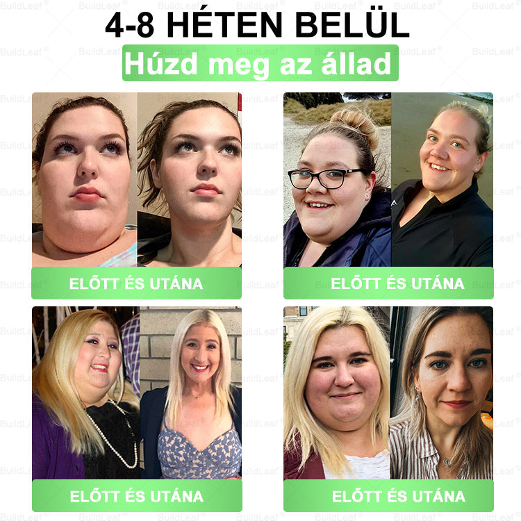 🧑‍⚕️DOOEKA® GLP-1 8-az-1 Slim & Healthy Szájon át Szedhető Oldat (Napi 1 adag · Eredmény 7 nap alatt),Segíti a fogyást, védi a szívet, szabályozza a cukorszintet, javítja az emésztést és az ízületeket — miközben feszesíti a bőrt és növeli az energiát.