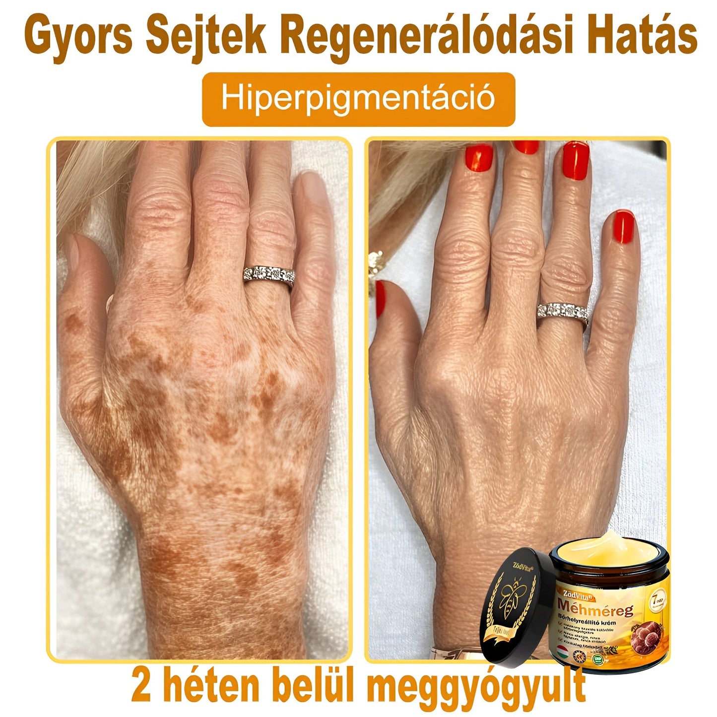 ✨✨Bőrgyógyász ajánlása ✨ ZödVita® Méhméreg Bőr Helyreállító Krém 🔥 Magyar fejlesztés, magyarországi gyártás és szállítás🔥✨