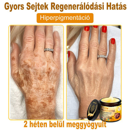 ✨✨Bőrgyógyász ajánlása ✨ ZödVita® Méhméreg Bőr Helyreállító Krém 🔥 Magyar fejlesztés, magyarországi gyártás és szállítás🔥✨