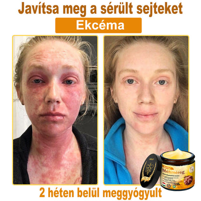 ✨✨Bőrgyógyász ajánlása ✨ ZödVita® Méhméreg Bőr Helyreállító Krém 🔥 Magyar fejlesztés, magyarországi gyártás és szállítás🔥🔥✨