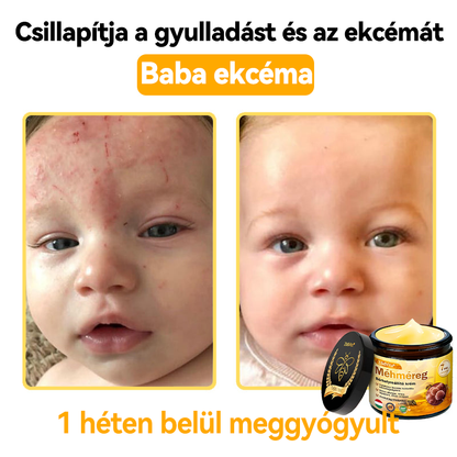 🌿Bőrgyógyász ajánlása💪ZödVita® Méhméreg Bőrhelyreállító Krém (👨‍⚕‍CE jóváhagyott)✅