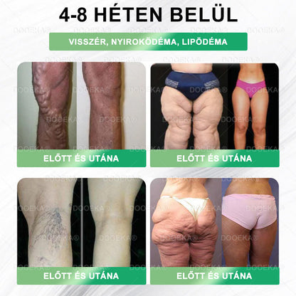 ✨✨DOOEKA® GLP-1 8 az 1-ben Fit & Vital Szájon át szedhető oldat – Napi egyszer, 7 nap alatt látható változás / Elhízás, szív- és érrendszeri egészség, cukorbetegség, alvási apnoe, bélrendszer egészsége, ízületi problémák és még sok más esetén