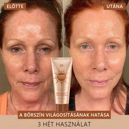𝐅𝐑𝐈𝐒𝐒𝐀𝐑𝐂™ Fehérítő És Folteltávolító Arcmaszk | Természetes összetevők tartósan eltüntetik a foltokat, szeplőket és napfoltokat