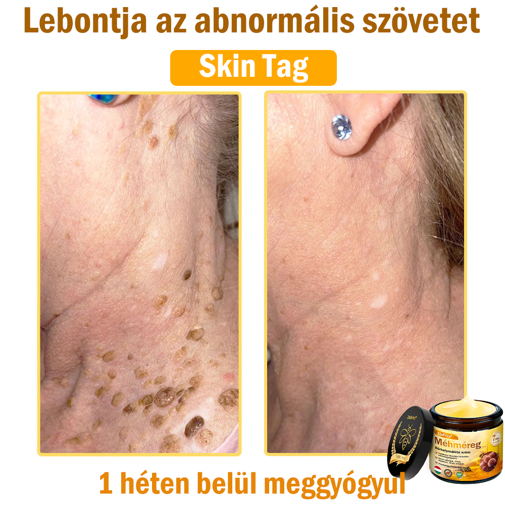 🌿Bőrgyógyász ajánlása💪ZödVita® Méhméreg Bőrhelyreállító Krém (👨‍⚕‍CE jóváhagyott)✅