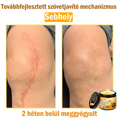 🌿Bőrgyógyász ajánlása💪ZödVita® Méhméreg Bőrhelyreállító Krém (👨‍⚕‍CE jóváhagyott)✅