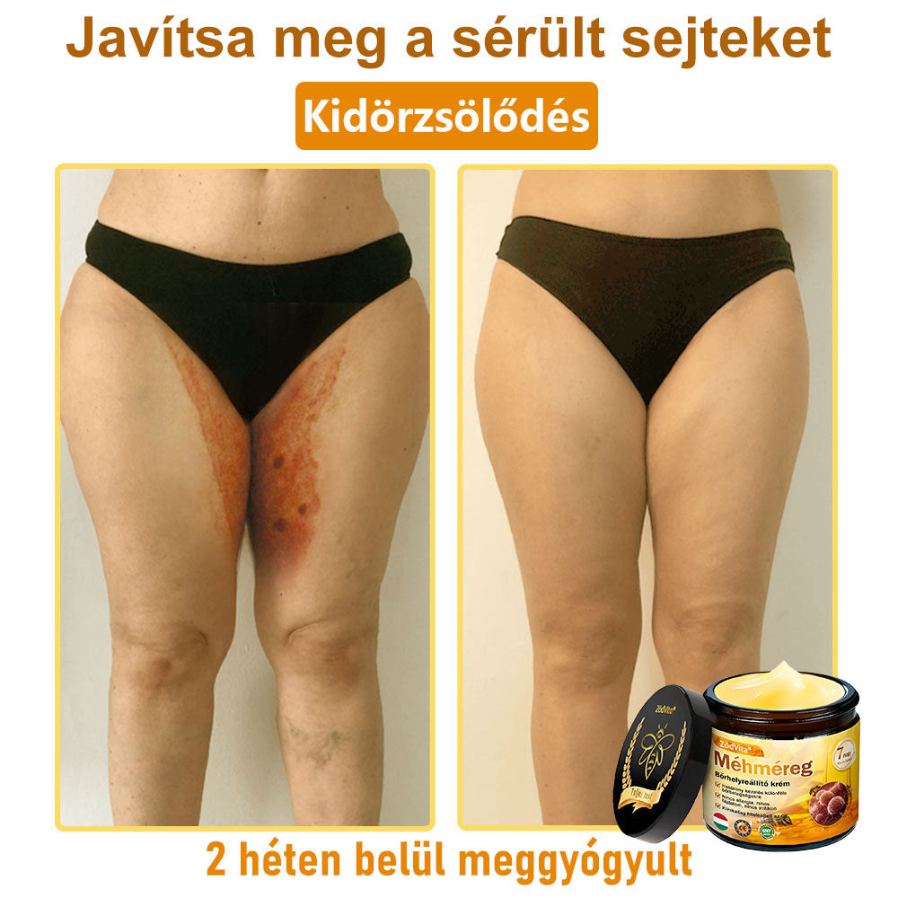 ✨✨Bőrgyógyász ajánlása ✨ ZödVita® Méhméreg Bőr Helyreállító Krém 🔥 Magyar fejlesztés, magyarországi gyártás és szállítás🔥🔥✨
