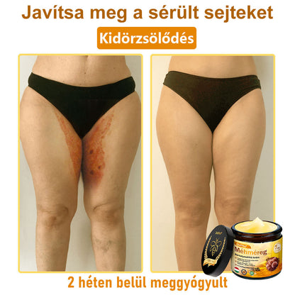 ✨✨Bőrgyógyász ajánlása ✨ ZödVita® Méhméreg Bőr Helyreállító Krém 🔥 Magyar fejlesztés, magyarországi gyártás és szállítás🔥🔥✨
