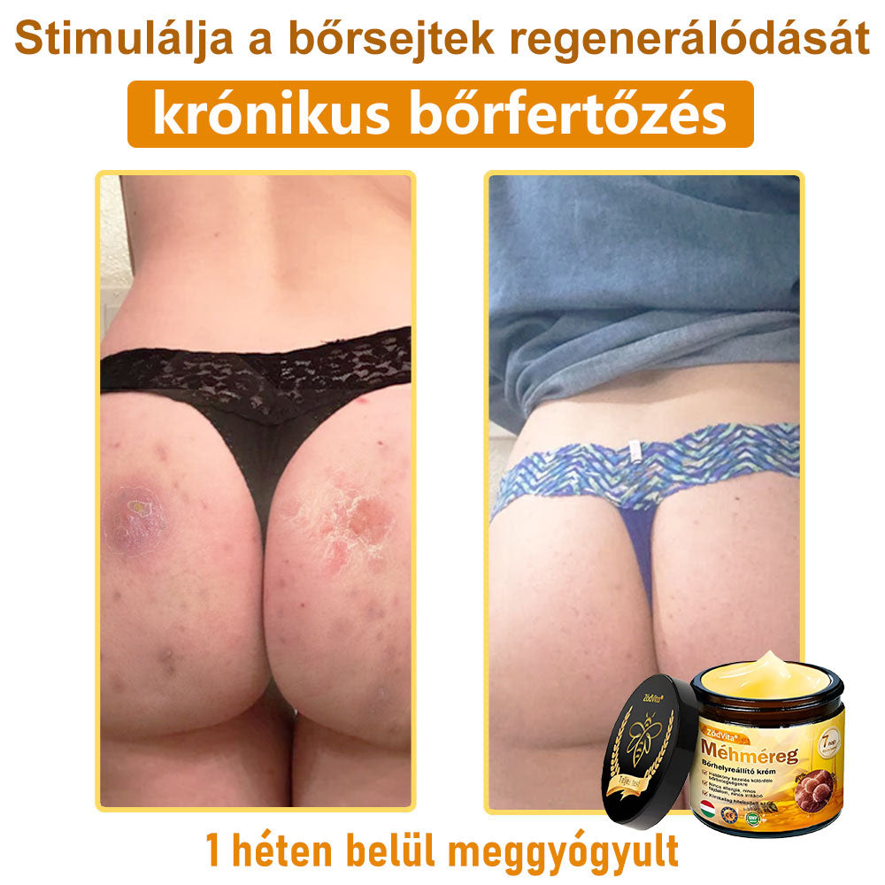 ✨✨Bőrgyógyász ajánlása ✨ ZödVita® Méhméreg Bőr Helyreállító Krém 🔥 Magyar fejlesztés, magyarországi gyártás és szállítás🔥🔥✨